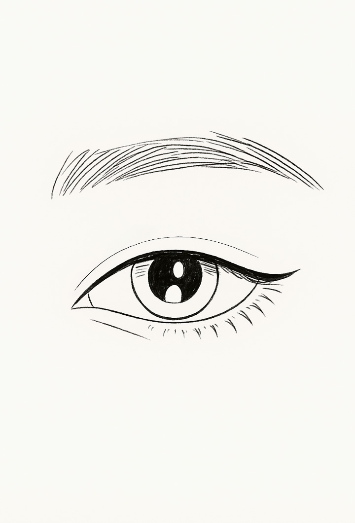 Midage Upper Eyelid Surgery 04