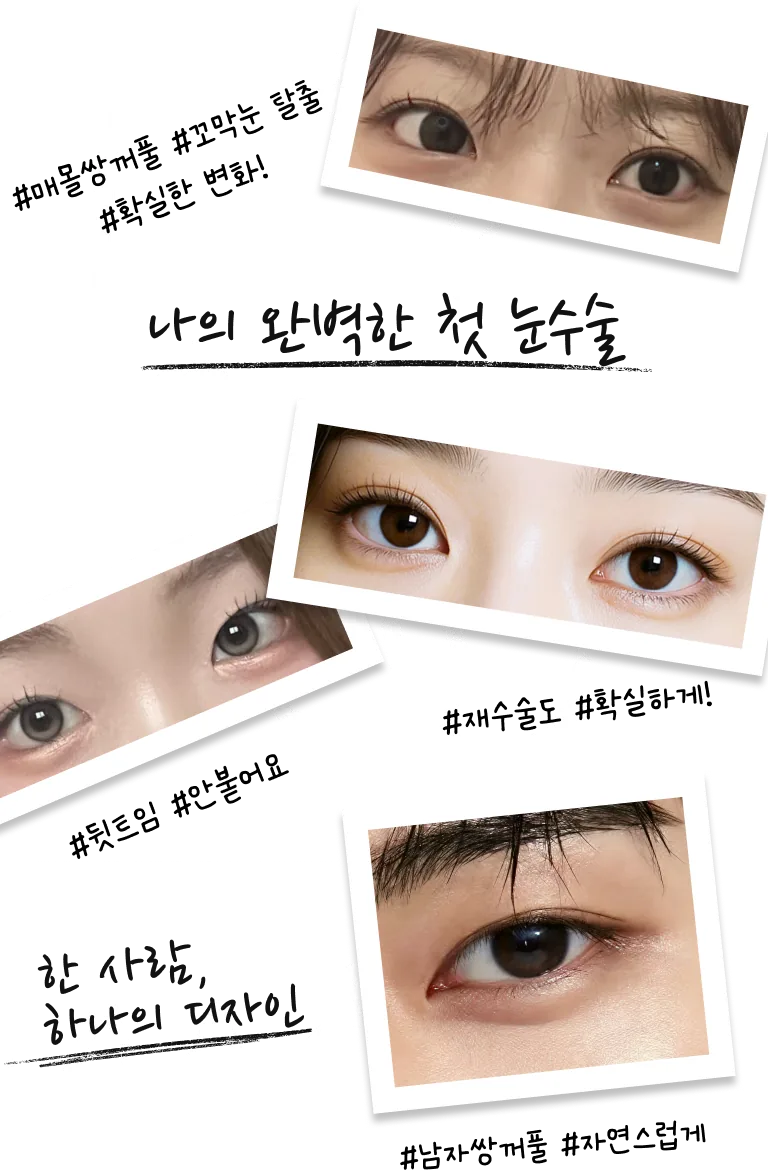사이성형외과 | 압구정 눈 성형 전문, 재수술도 확실하게
